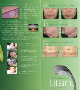 titan